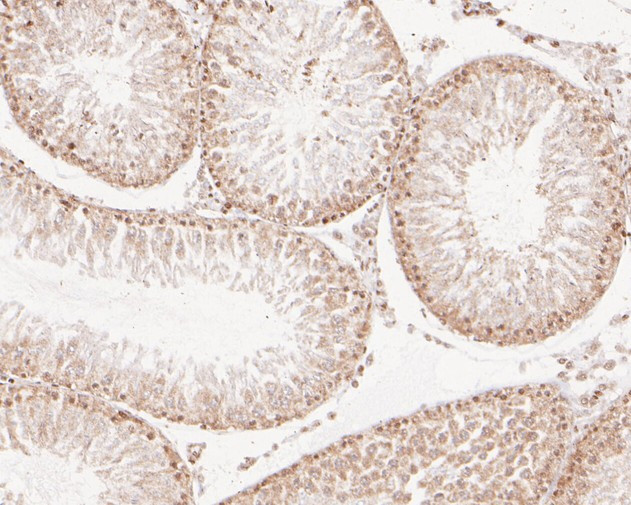 NFYA Antibody in Immunohistochemistry (Paraffin) (IHC (P))