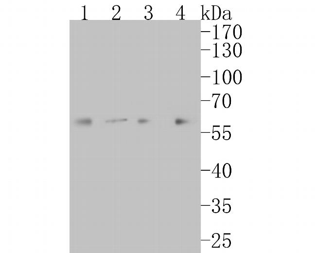 LGI1 Antibody in Western Blot (WB)