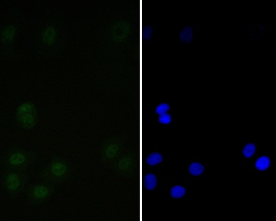 Tat-SF1 Antibody in Immunocytochemistry (ICC/IF)