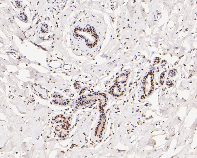 Tat-SF1 Antibody in Immunohistochemistry (Paraffin) (IHC (P))