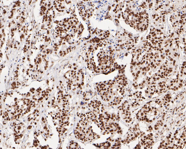 Tat-SF1 Antibody in Immunohistochemistry (Paraffin) (IHC (P))