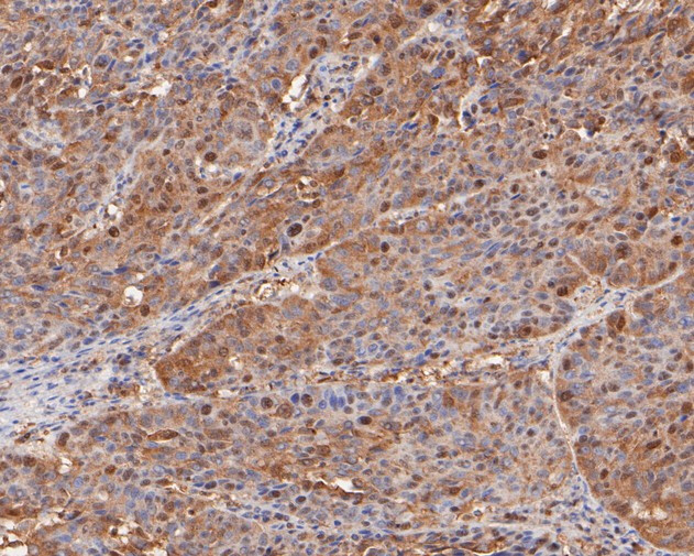 BAT3 Antibody in Immunohistochemistry (Paraffin) (IHC (P))