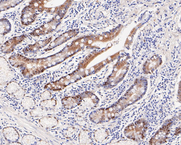 PEX19 Antibody in Immunohistochemistry (Paraffin) (IHC (P))