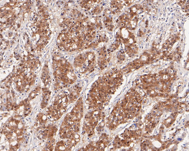 PEX19 Antibody in Immunohistochemistry (Paraffin) (IHC (P))