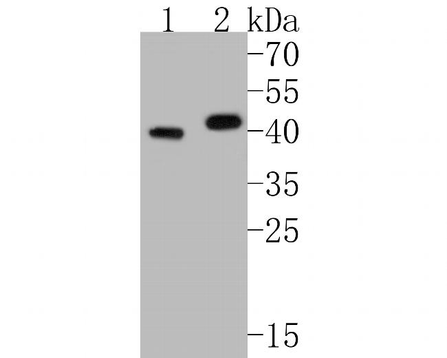 Kallikrein 5 Antibody in Western Blot (WB)