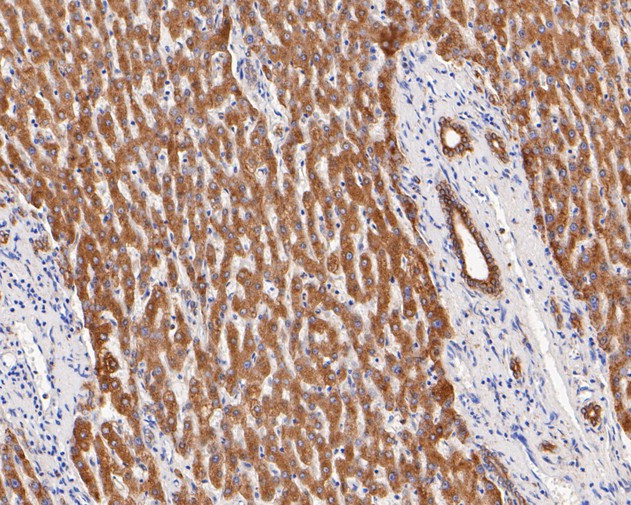 P4HB Antibody in Immunohistochemistry (Paraffin) (IHC (P))