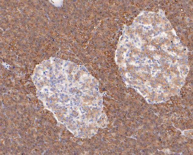 P4HB Antibody in Immunohistochemistry (Paraffin) (IHC (P))