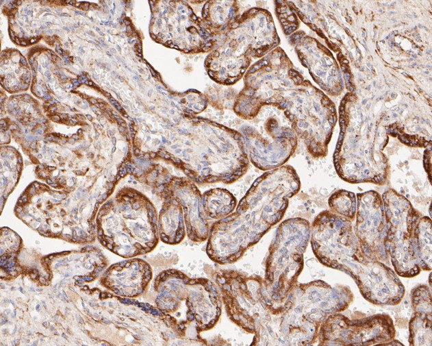 P4HB Antibody in Immunohistochemistry (Paraffin) (IHC (P))