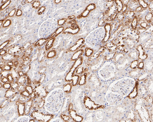 P4HB Antibody in Immunohistochemistry (Paraffin) (IHC (P))