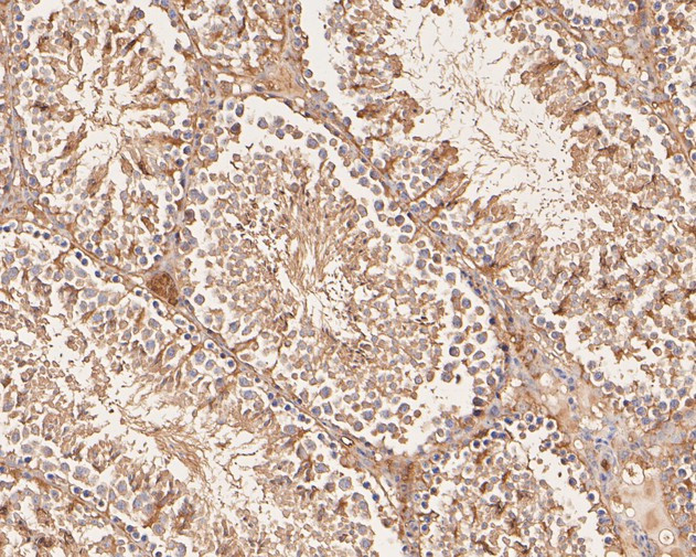 VPS28 Antibody in Immunohistochemistry (Paraffin) (IHC (P))