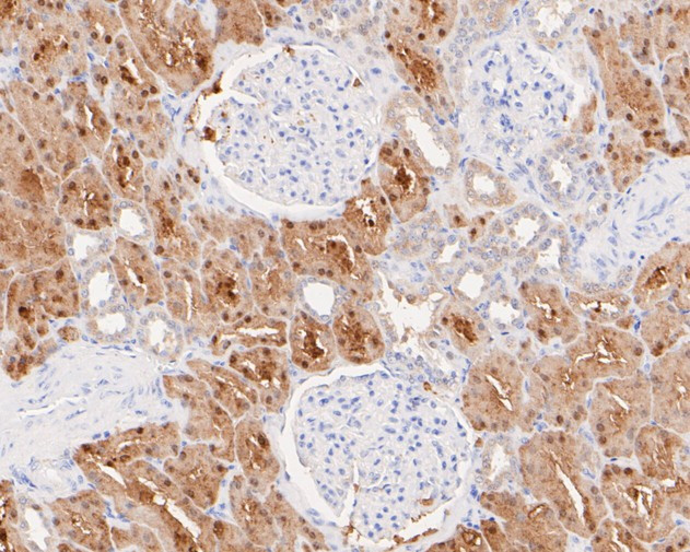 Glycerol kinase Antibody in Immunohistochemistry (Paraffin) (IHC (P))