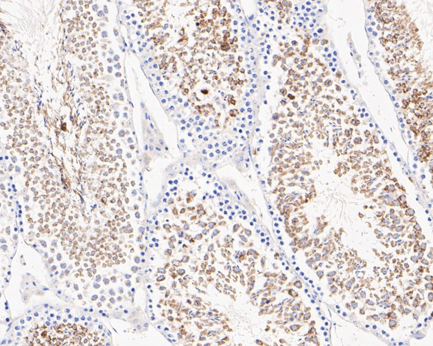 Glycerol kinase Antibody in Immunohistochemistry (Paraffin) (IHC (P))