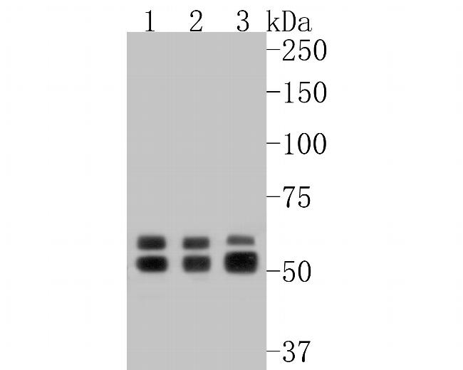 Glycerol kinase Antibody in Western Blot (WB)