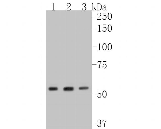 LMAN1 Antibody in Western Blot (WB)