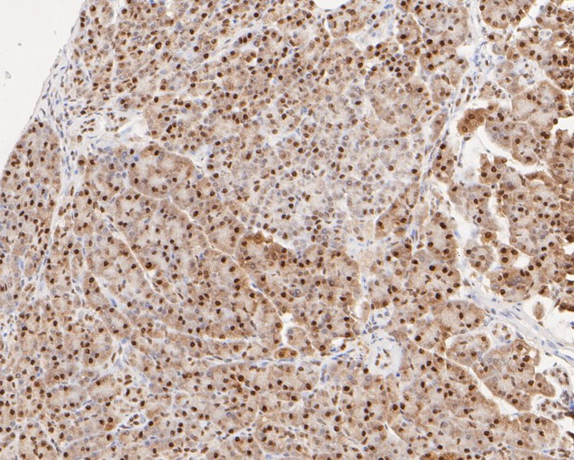 SUPT5H Antibody in Immunohistochemistry (Paraffin) (IHC (P))