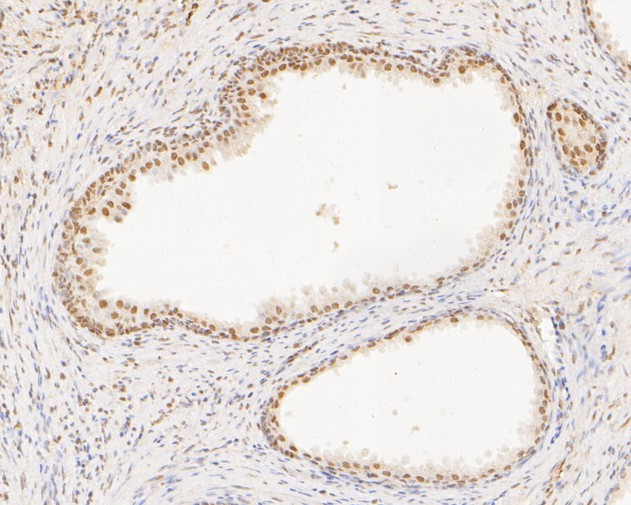 SUPT5H Antibody in Immunohistochemistry (Paraffin) (IHC (P))