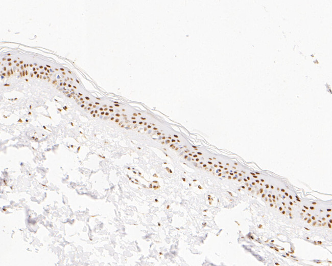 SUPT5H Antibody in Immunohistochemistry (Paraffin) (IHC (P))