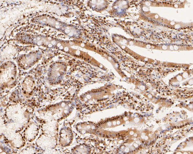 SUPT5H Antibody in Immunohistochemistry (Paraffin) (IHC (P))