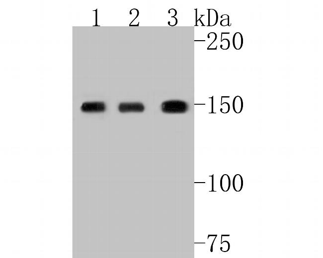 SUPT5H Antibody in Western Blot (WB)