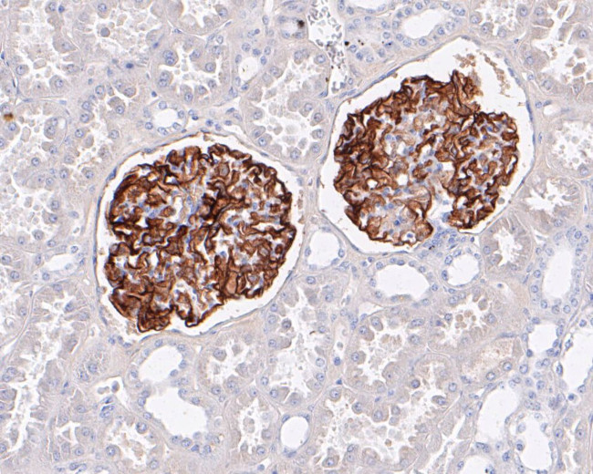 CD35 Antibody in Immunohistochemistry (Paraffin) (IHC (P))