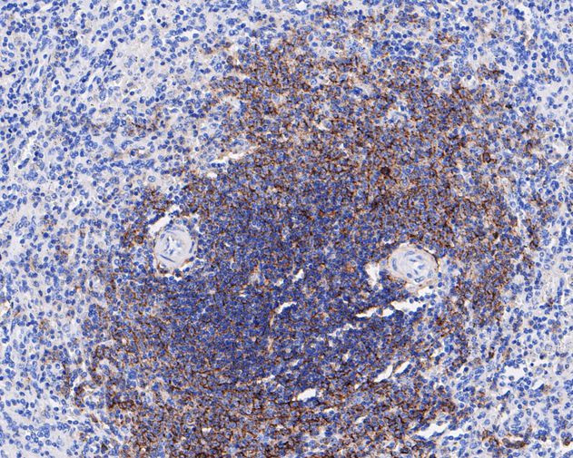 CD35 Antibody in Immunohistochemistry (Paraffin) (IHC (P))