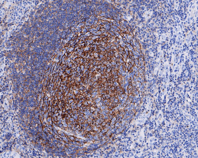 CD35 Antibody in Immunohistochemistry (Paraffin) (IHC (P))