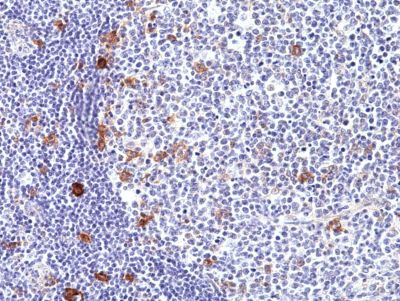 CD30 Antibody in Immunohistochemistry (Paraffin) (IHC (P))