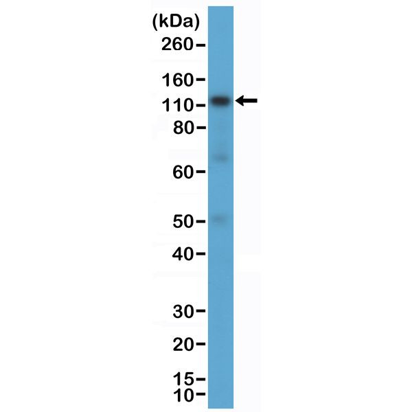 CD30 Antibody in Western Blot (WB)