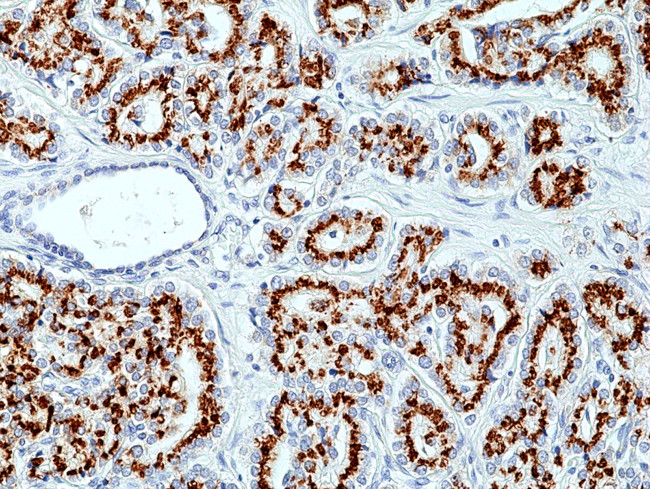 Prostein Antibody in Immunohistochemistry (Paraffin) (IHC (P))