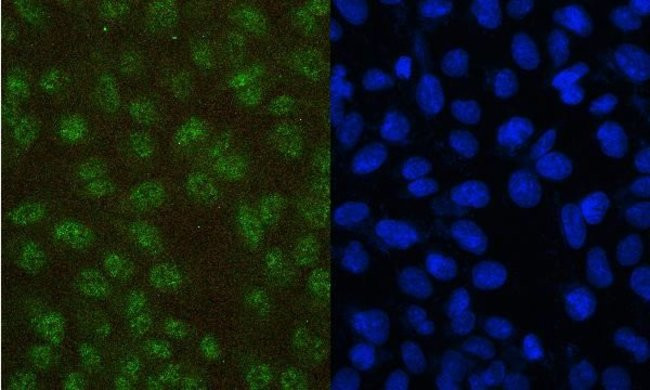 PAX5 Antibody in Immunocytochemistry (ICC/IF)