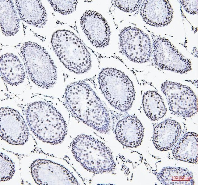 NRF1 Antibody in Immunohistochemistry (Paraffin) (IHC (P))