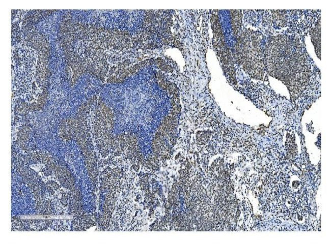 NRF1 Antibody in Immunohistochemistry (Paraffin) (IHC (P))