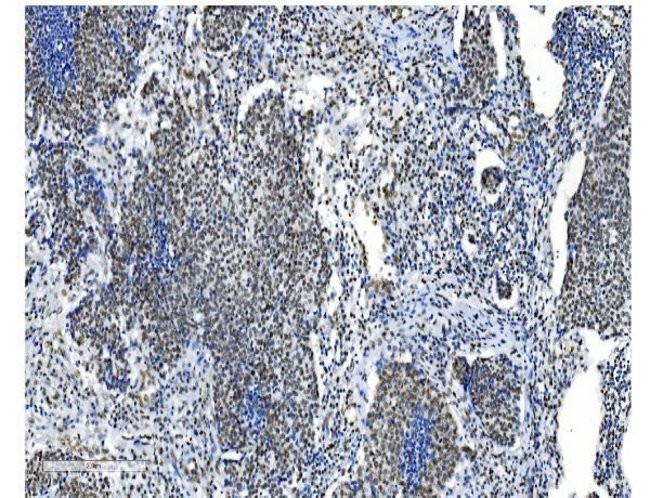 NRF1 Antibody in Immunohistochemistry (Paraffin) (IHC (P))