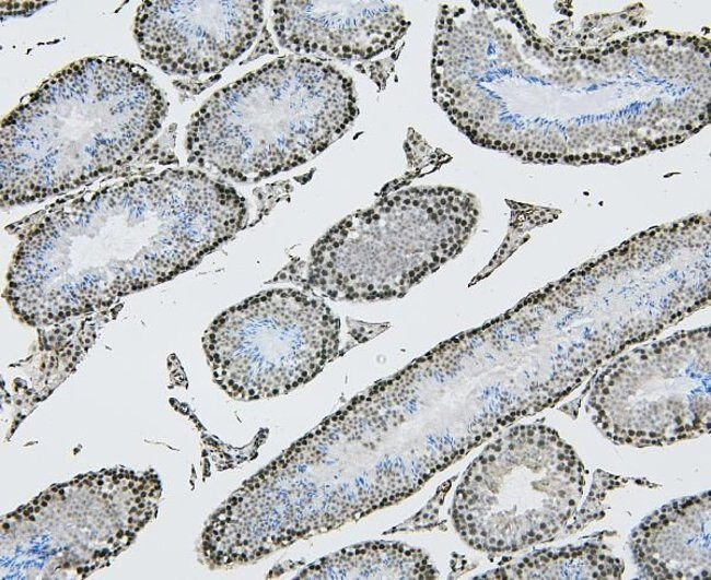 NRF1 Antibody in Immunohistochemistry (Paraffin) (IHC (P))