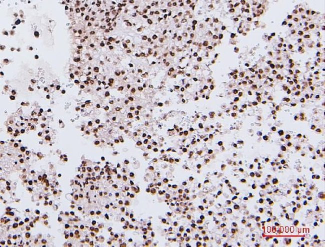 NRF1 Antibody in Immunohistochemistry (Paraffin) (IHC (P))