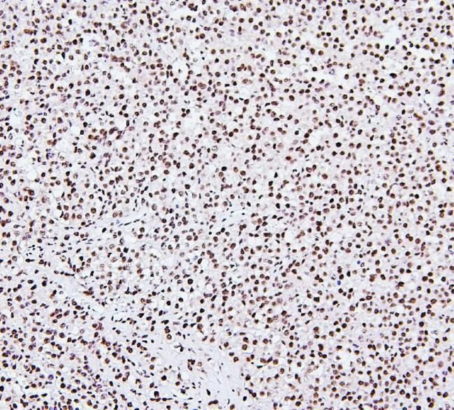 NRF1 Antibody in Immunohistochemistry (Paraffin) (IHC (P))