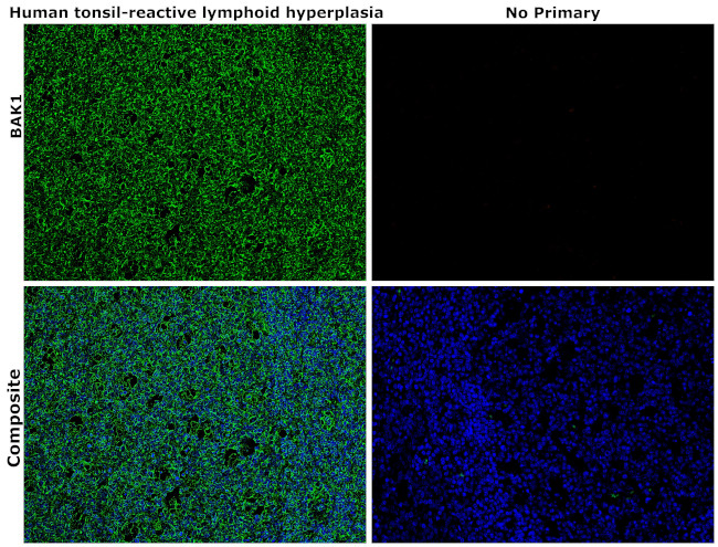 BAK1 Antibody in Immunohistochemistry (Paraffin) (IHC (P))