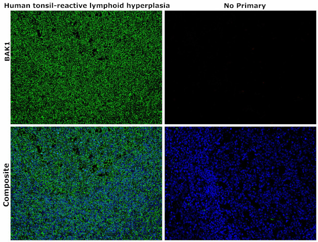 BAK1 Antibody in Immunohistochemistry (Paraffin) (IHC (P))