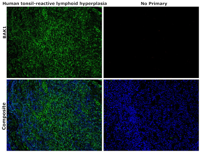 BAK1 Antibody in Immunohistochemistry (Paraffin) (IHC (P))