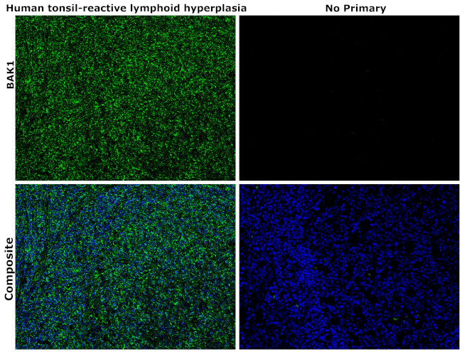 BAK1 Antibody in Immunohistochemistry (Paraffin) (IHC (P))