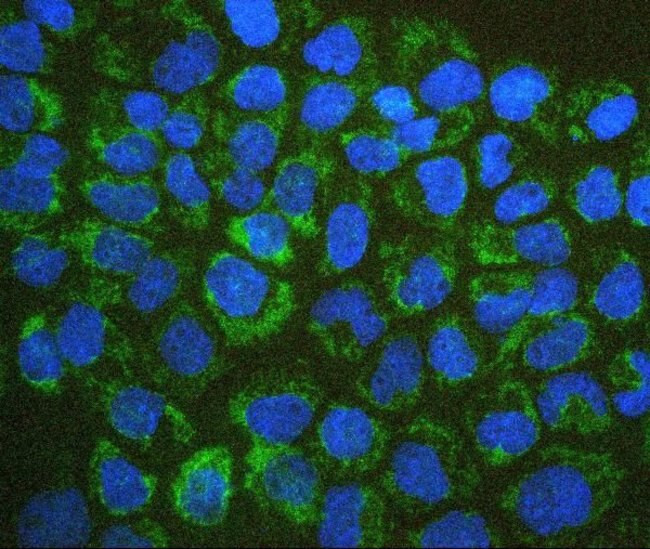 BAK1 Antibody in Immunocytochemistry (ICC/IF)