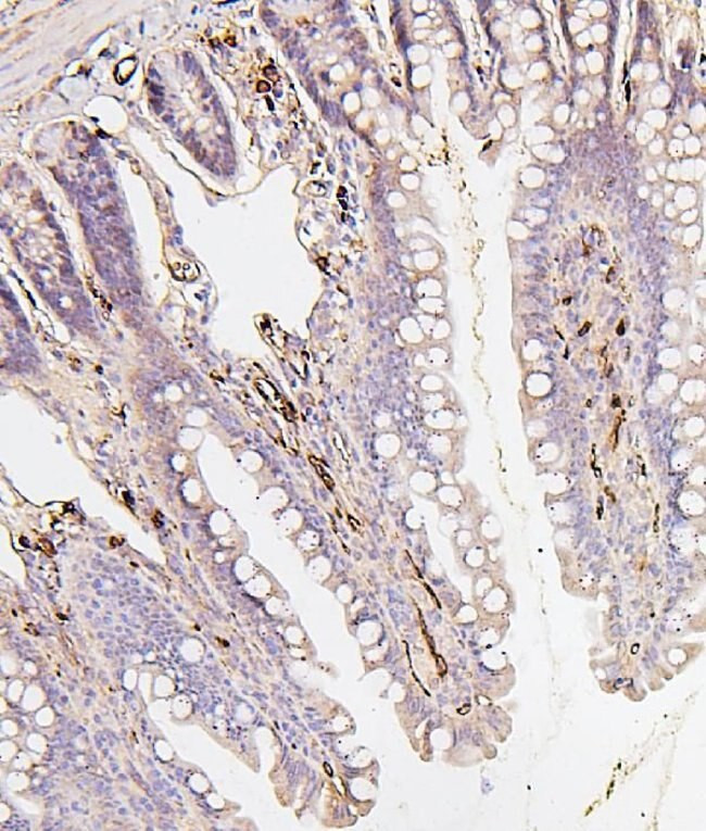 BAK1 Antibody in Immunohistochemistry (Paraffin) (IHC (P))