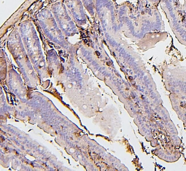 BAK1 Antibody in Immunohistochemistry (Paraffin) (IHC (P))