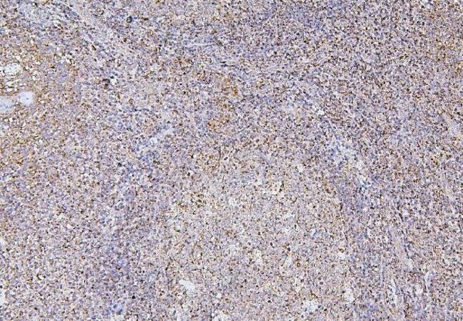 BAK1 Antibody in Immunohistochemistry (Paraffin) (IHC (P))