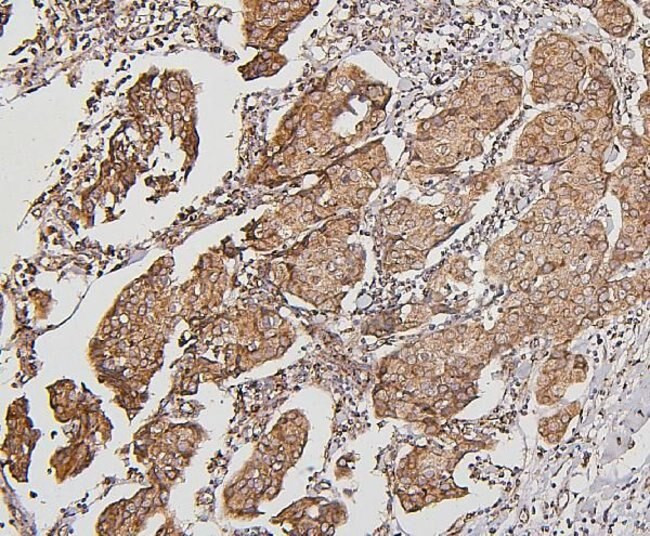 BAK1 Antibody in Immunohistochemistry (Paraffin) (IHC (P))