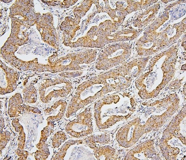 BAK1 Antibody in Immunohistochemistry (Paraffin) (IHC (P))