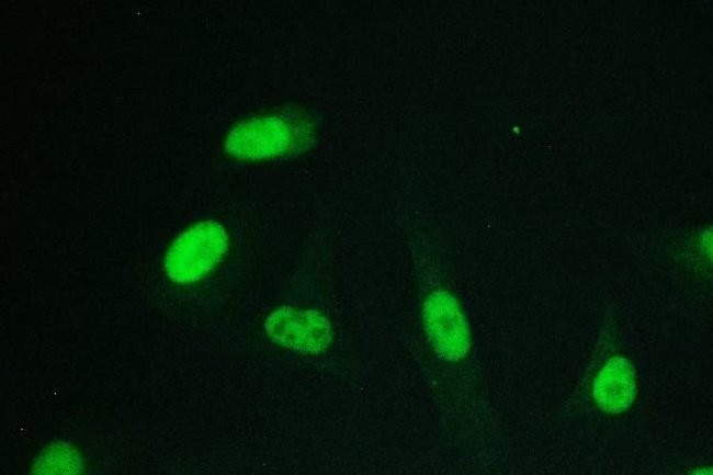 RPA70 Antibody in Immunocytochemistry (ICC/IF)