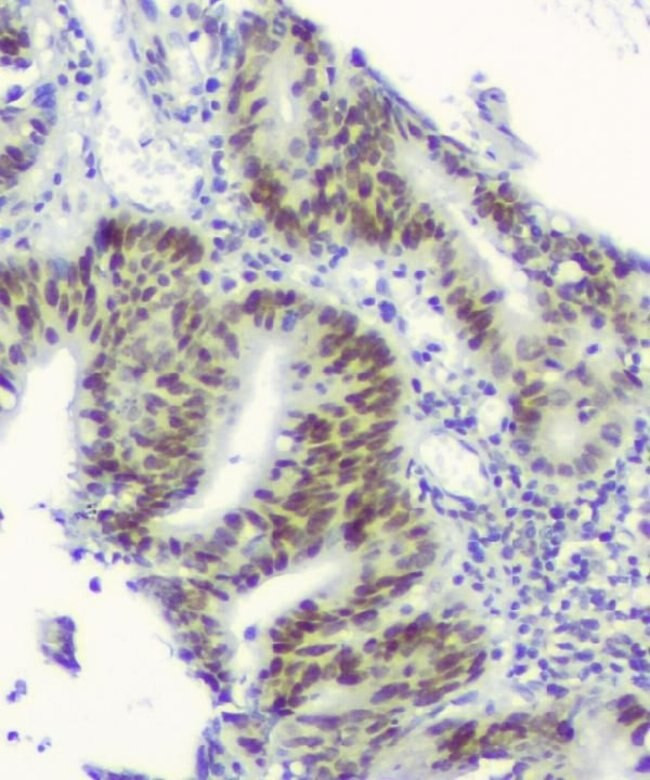 RPA70 Antibody in Immunohistochemistry (Paraffin) (IHC (P))