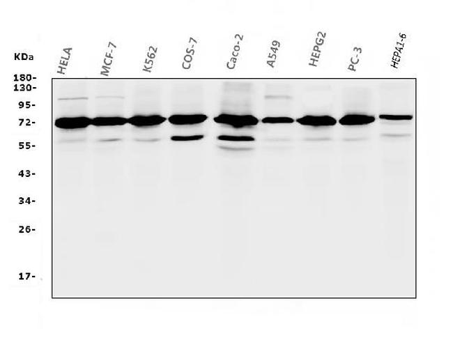 RPA70 Antibody in Western Blot (WB)