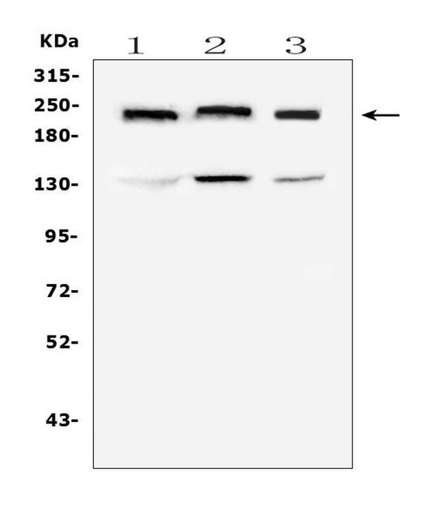 Collagen IV Antibody in Western Blot (WB)